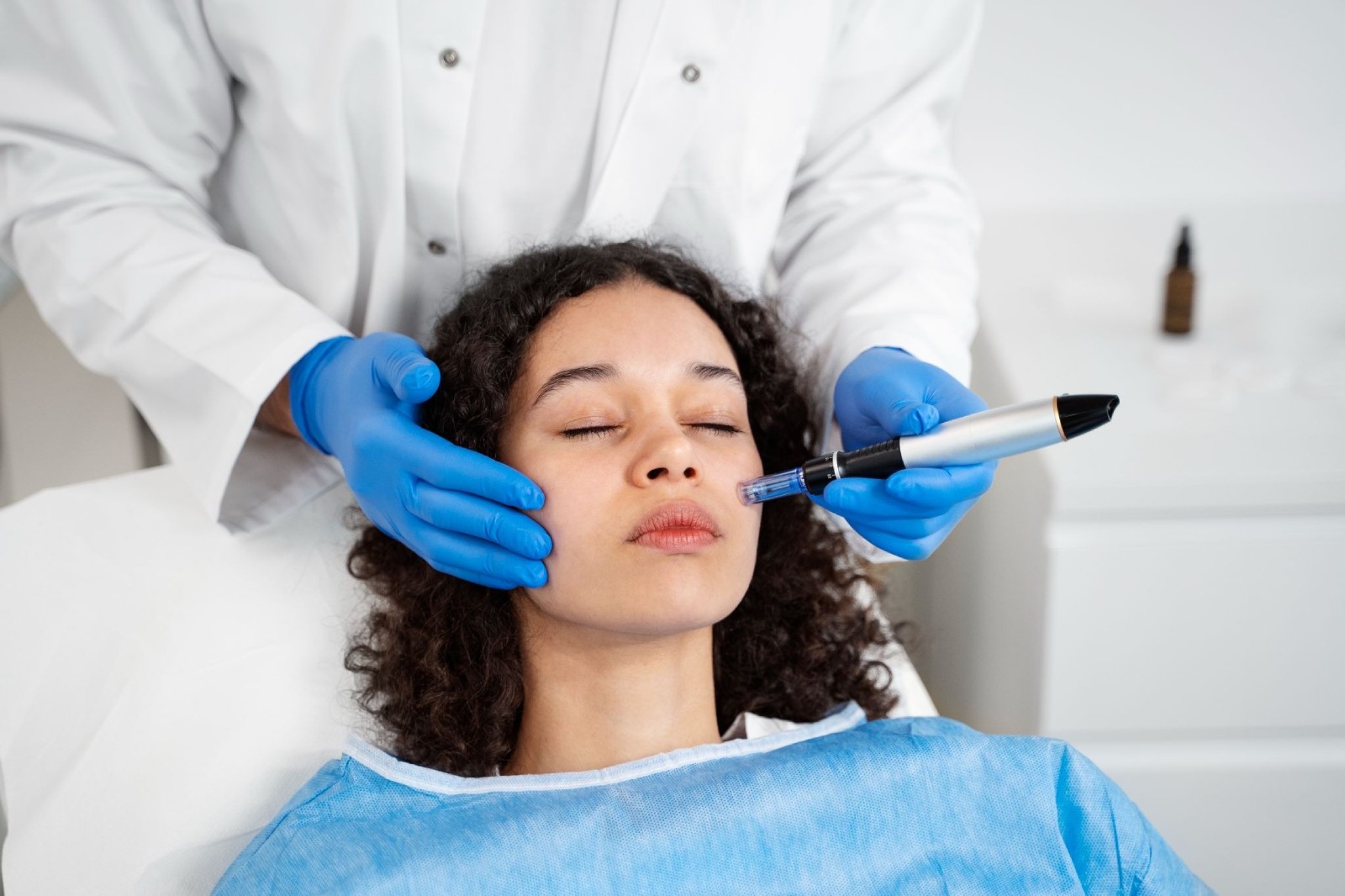10 Reasons to Choose Professional Microneedling for Smoother Skin and Acne Scar Reduction